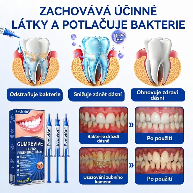 Evolvion® GumRevive