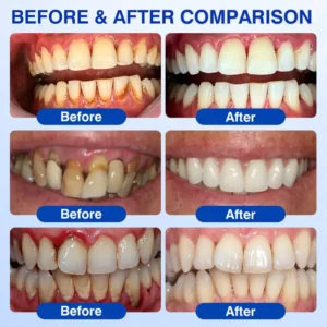 Evolvion® GumCare Pro