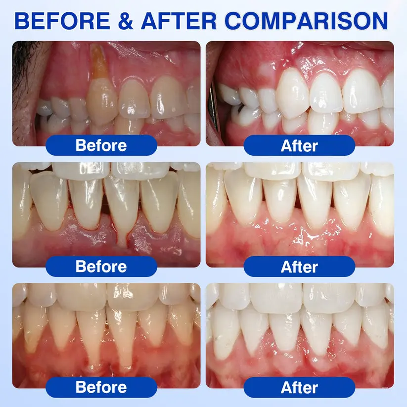 Evolvion® GumCare Pro