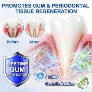 Evolvion® GumCare Pro