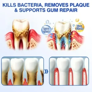 Evolvion® GumRevive Periodontal Repair Gel
