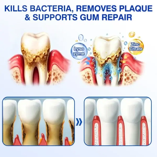 Evolvion® GumRevive Periodontal Repair Gel