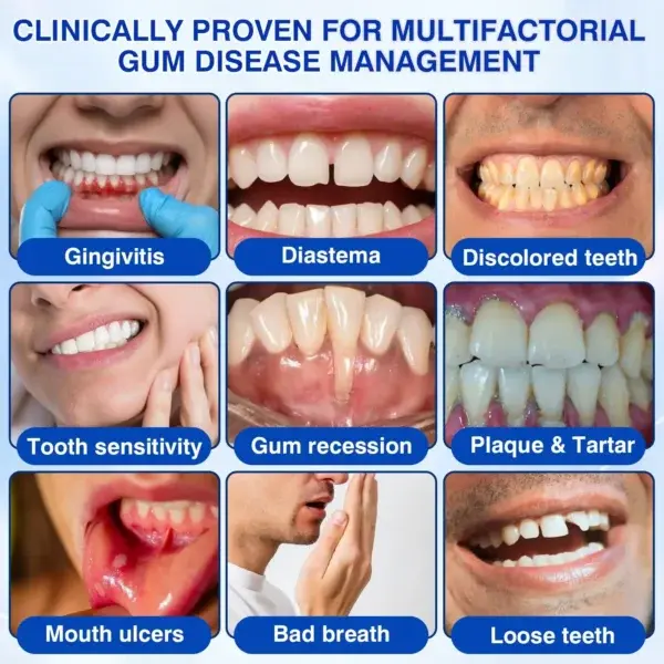 Evolvion® GumRevive Periodontal Repair Gel