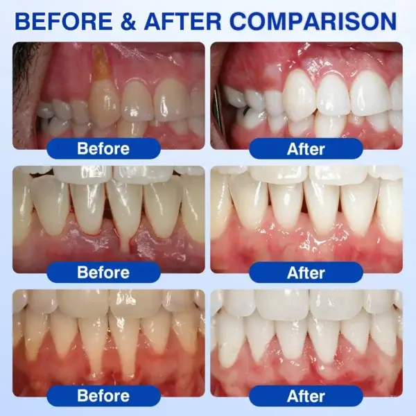Evolvion® GumRevive Periodontal Repair Gel