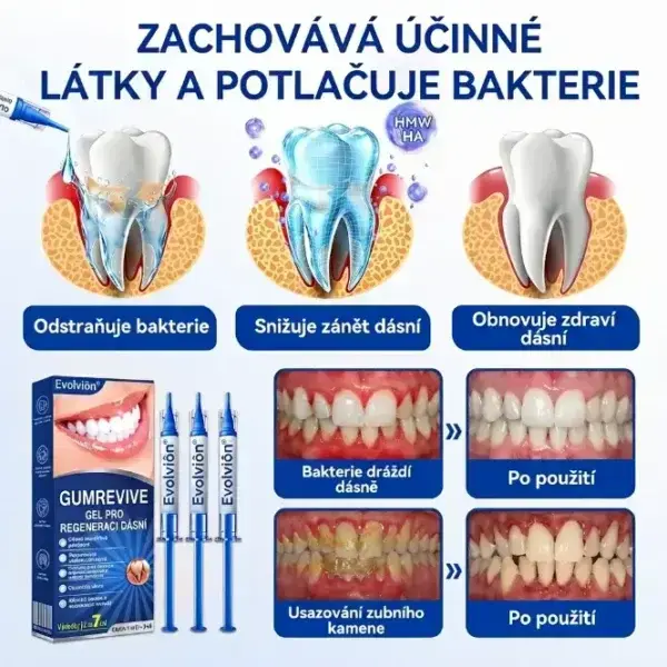 Evolvion® GumRevive