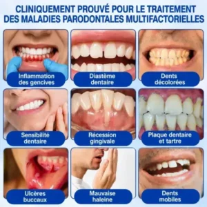 Gel Régénération Parodontale