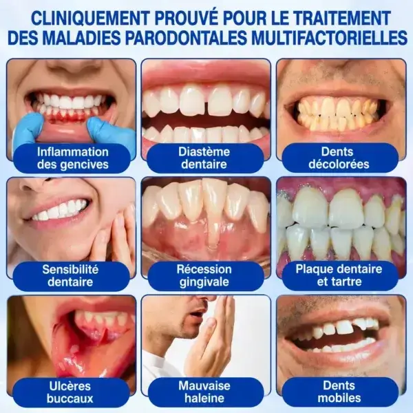 Gel Régénération Parodontale