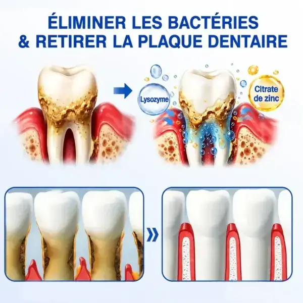 Gel Régénération Parodontale
