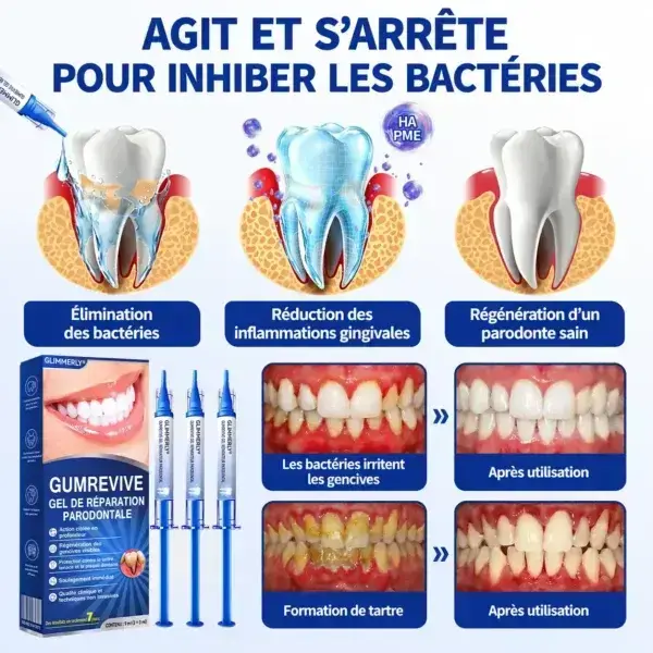Gel Régénération Parodontale