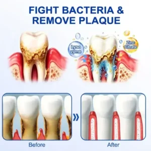Glimmerly® GumRevive Periodontal Repair Gel