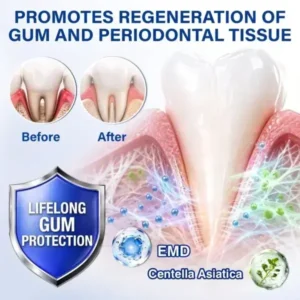 SOLAROZA® GumRevive Periodontal Repair Gel